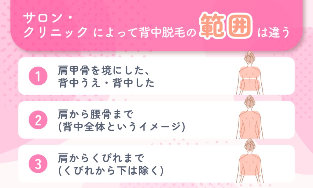 クリニック・サロンによって背中脱毛の範囲は違う 肩甲骨を境にした背中上 背中下 肩から腰骨まで 肩からくびれまで
