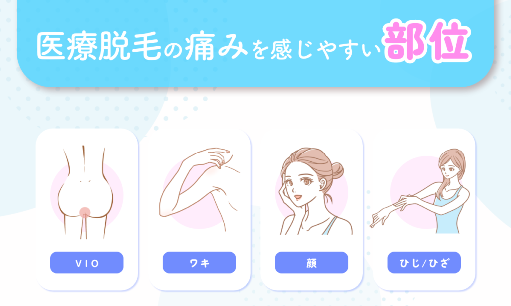 医療脱毛の痛みを感じやすい部位をご紹介。VIO/ワキ/顔/ひじ・ひざなどがあります。