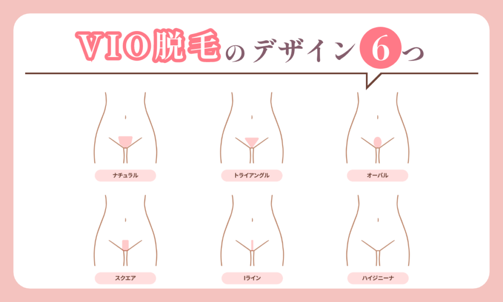 VIO脱毛のデザインを6つご紹介